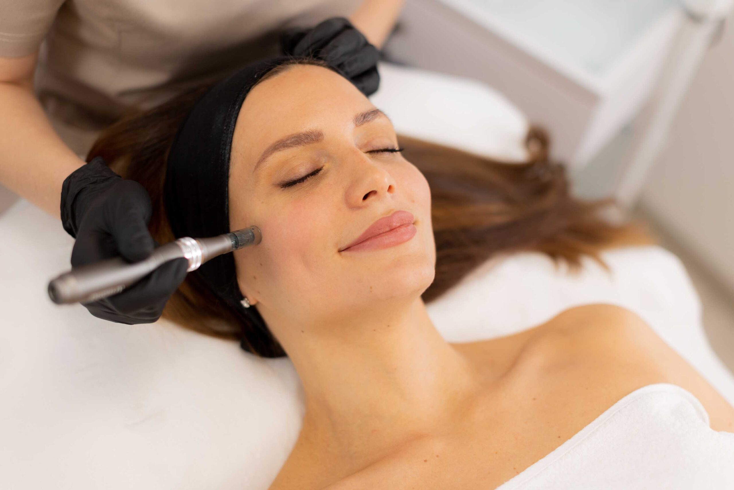 Kvinne får skånsom microneedling behandling med et svarte pannebånn og profesjonelt utstyr