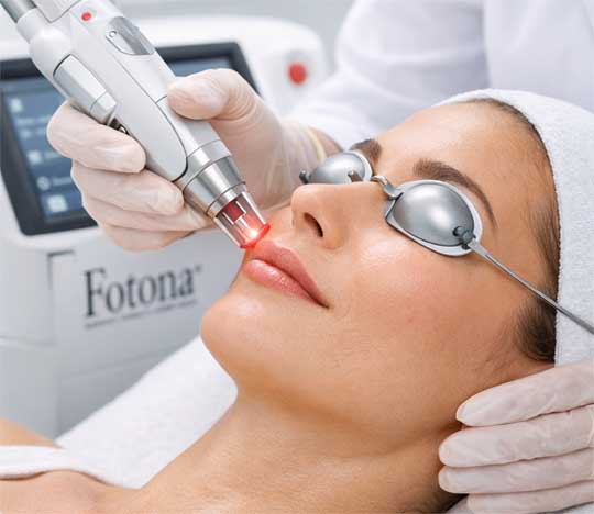 LipLase-Fyldigere lepper uten fillers